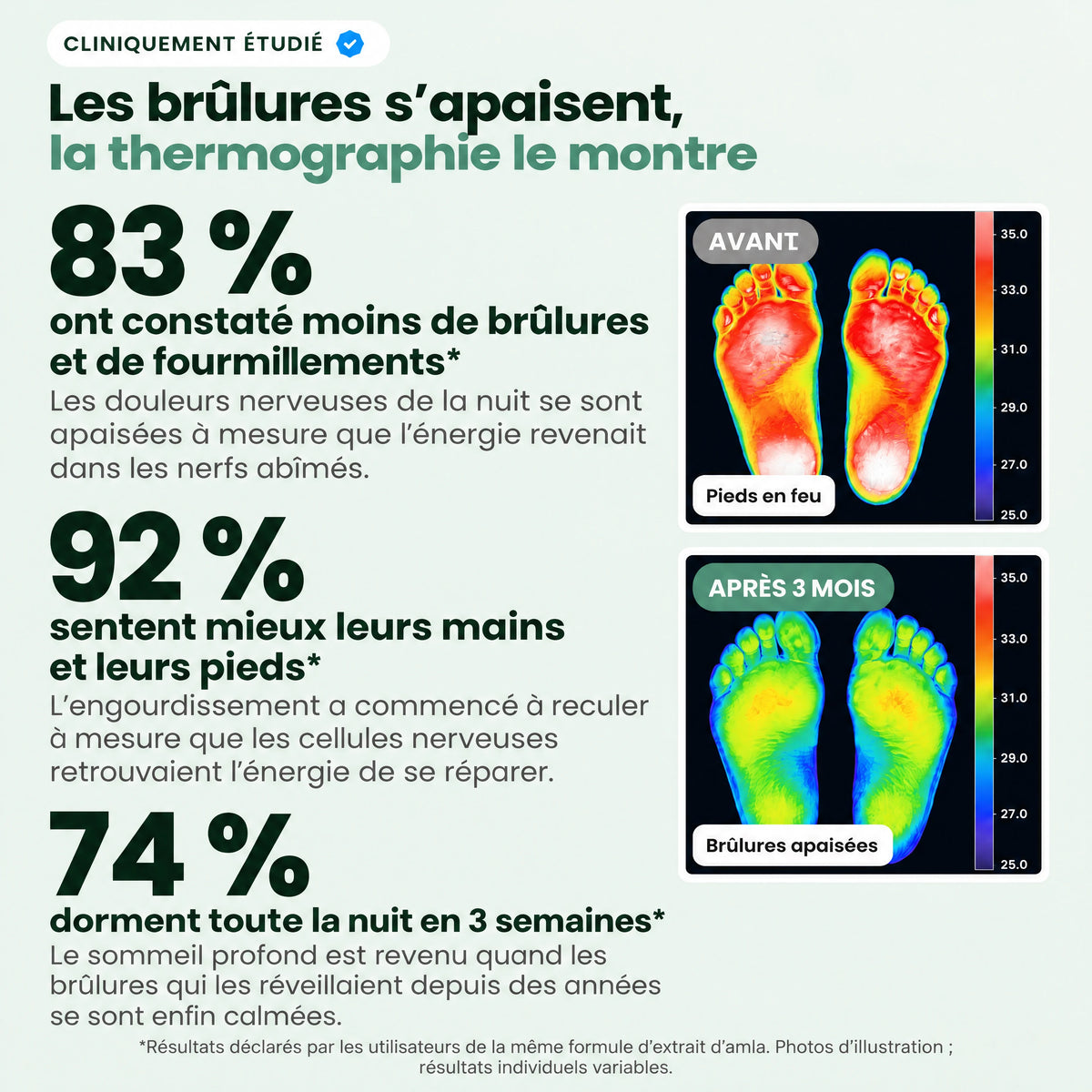 Les brûlures s'apaisent : avant et après 3 mois